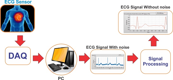 پردازش سیگنال ECG با لب ویو
